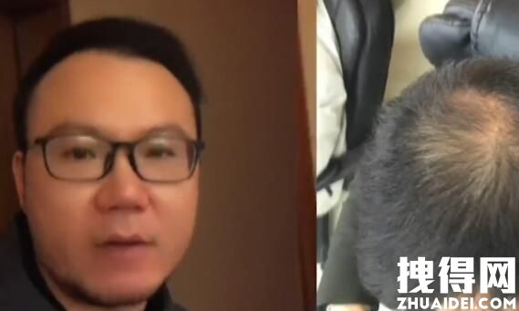 男子回应&ldquo;不用洗发水变满头黑发&rdquo;，机构这样直言！